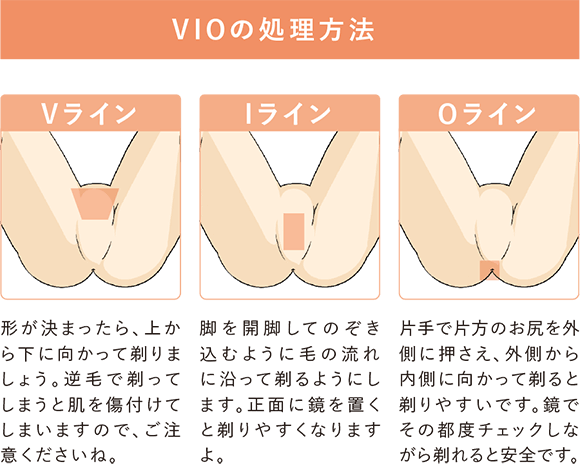 VIOシェービングの手順,コツ