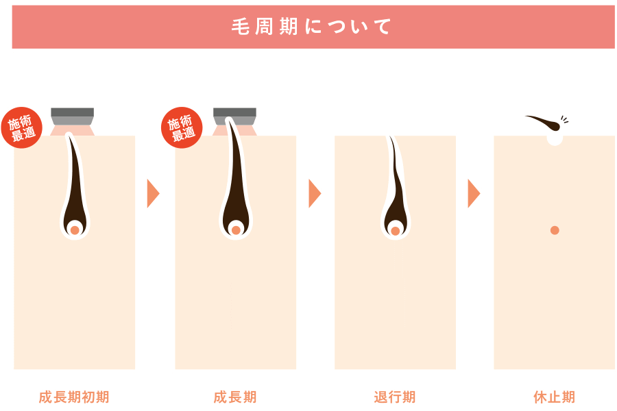 毛周期とは？脱毛との関係性。施術周期について