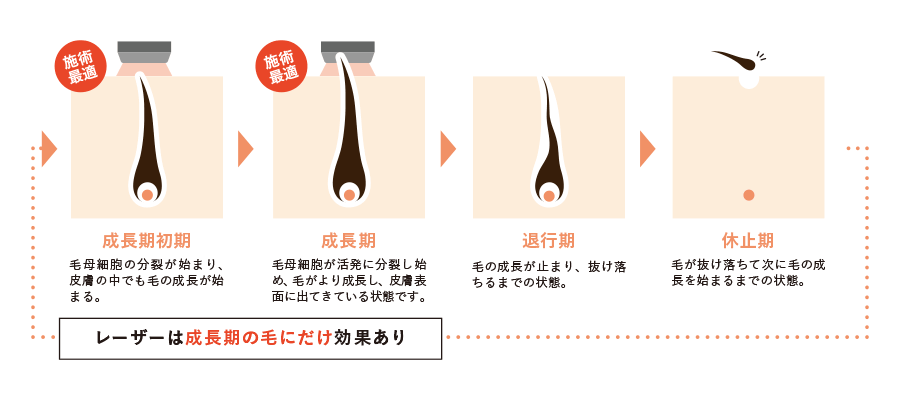 毛周期と脱毛に適した期間